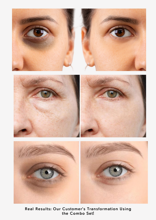 The Ordinary Dark Circles and Puffiness Treatment Set - Treatment for dark spots - view 2