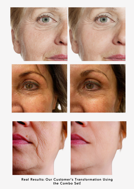 The Ordinary Youthful Skin Set - Sunscreen for dark spots - view 2