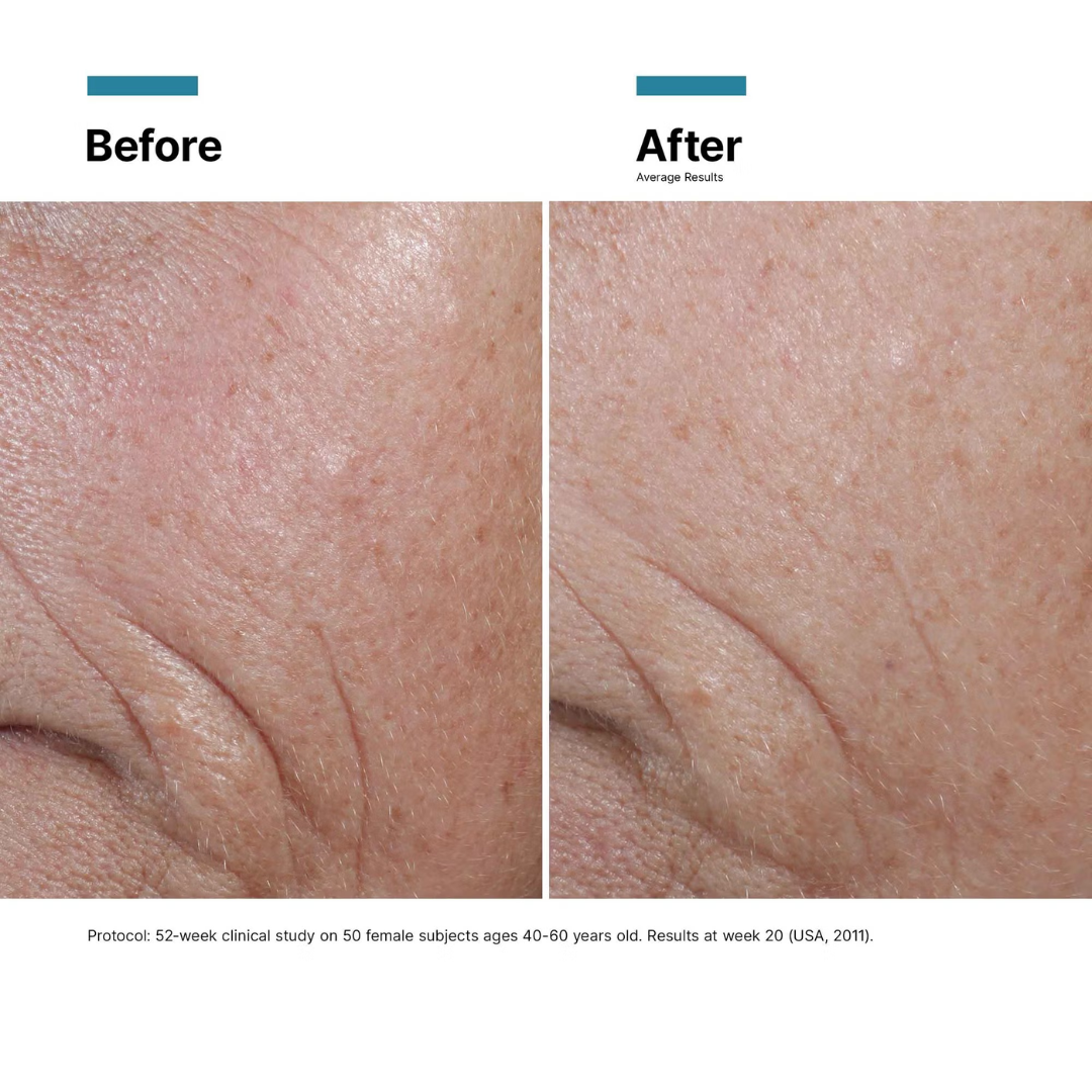 C E Ferulic® with 15% L-Ascorbic Acid (3 Packs)