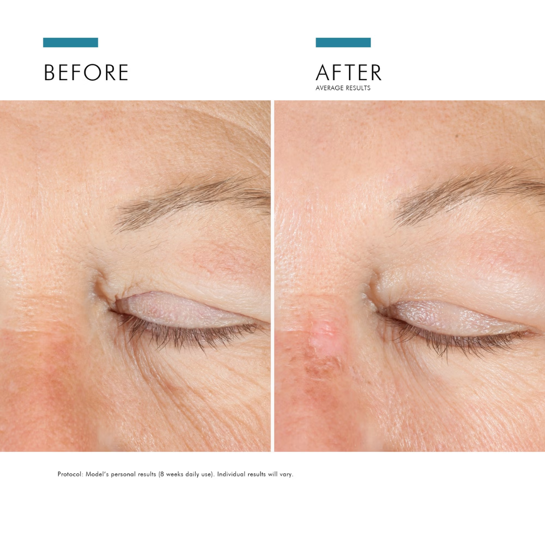 SkinCeuticals A.G.E. Advanced Eye for Dark Circles & Wrinkles 15ml