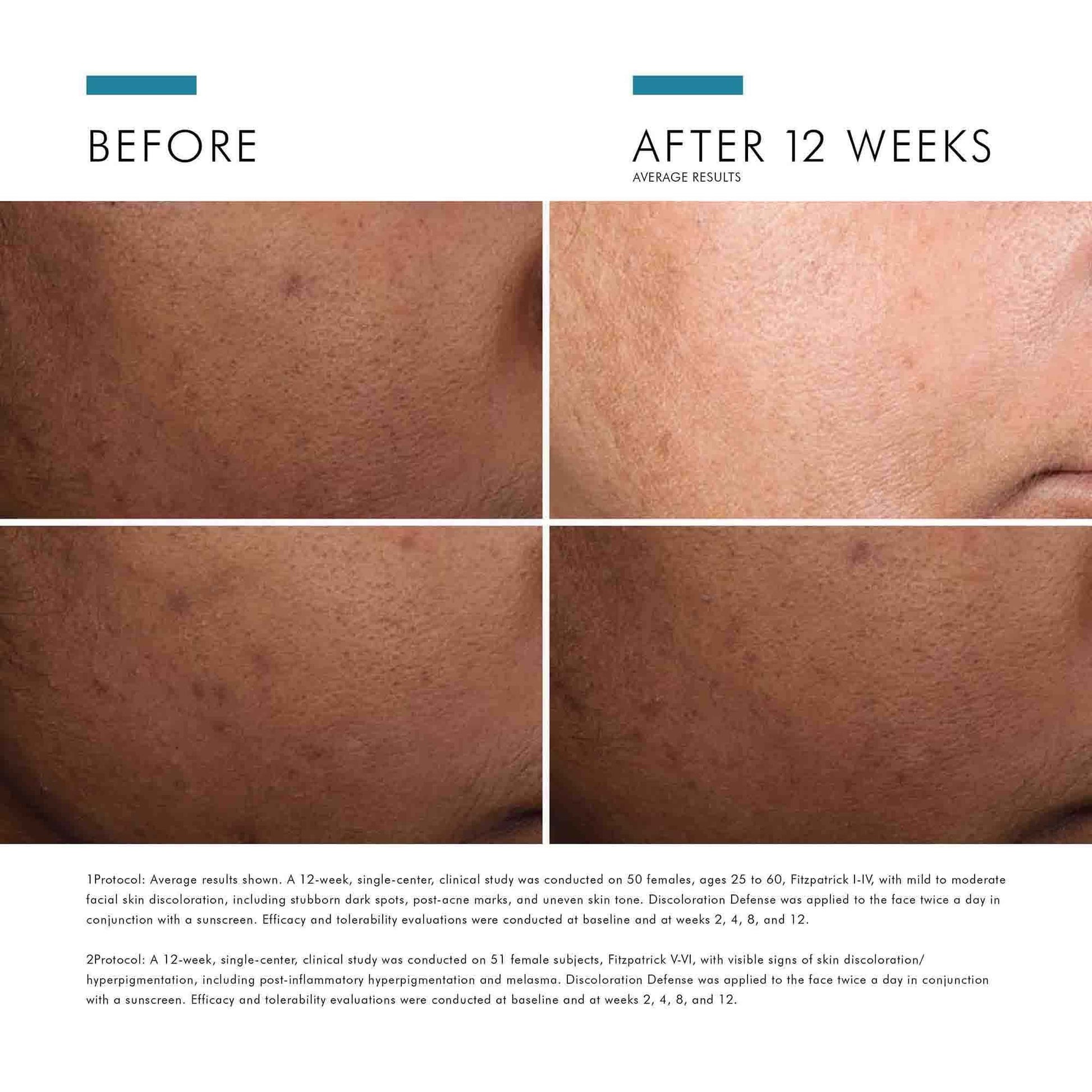SkinCeuticals Discoloration Defense 30ml - Sunscreen for dark spots - view 6