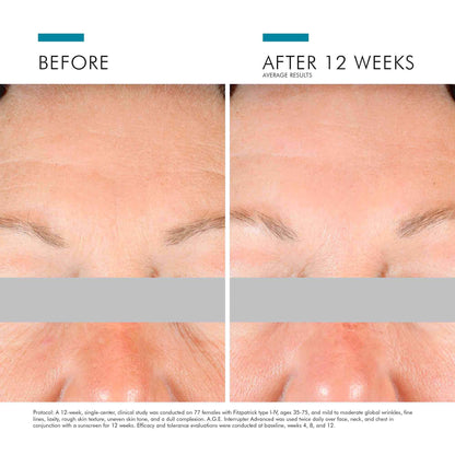 SkinCeuticals A.G.E. Interrupter 48ml - Sunscreen for anti-aging - view 5