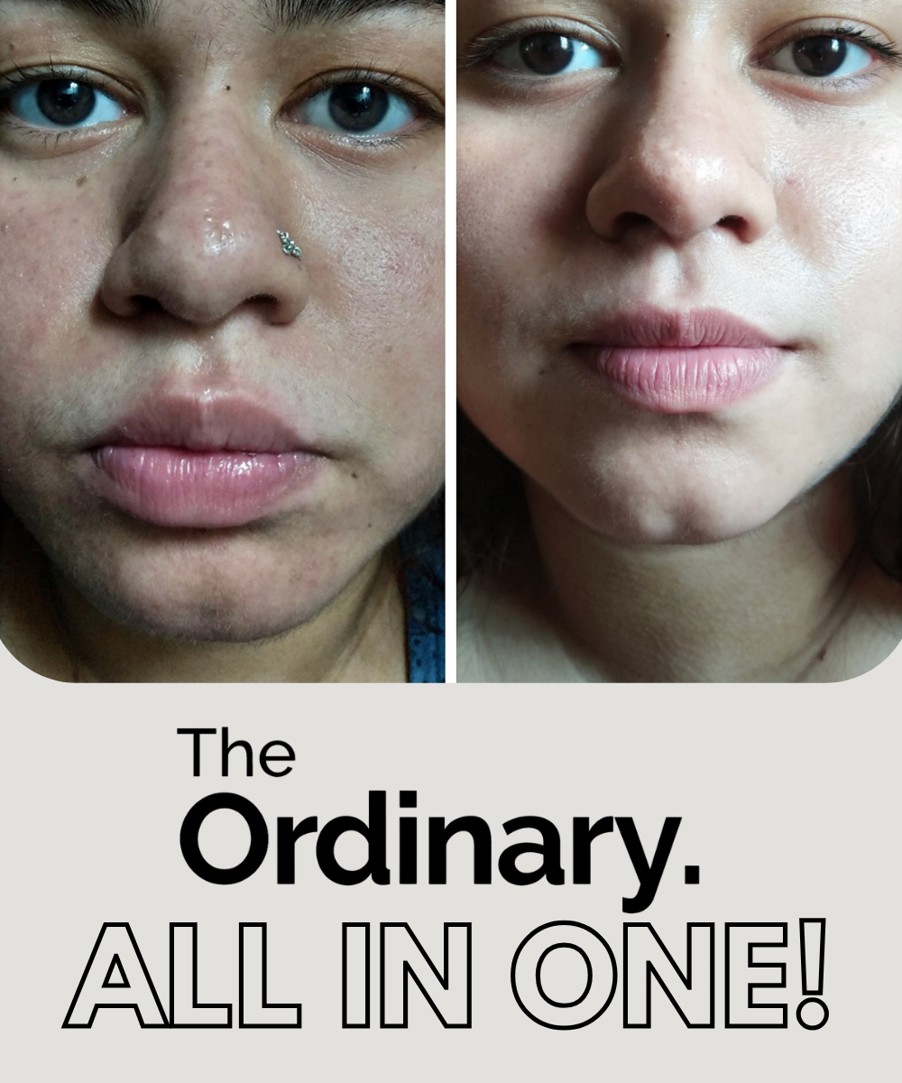 The Ordinary All In One Combo