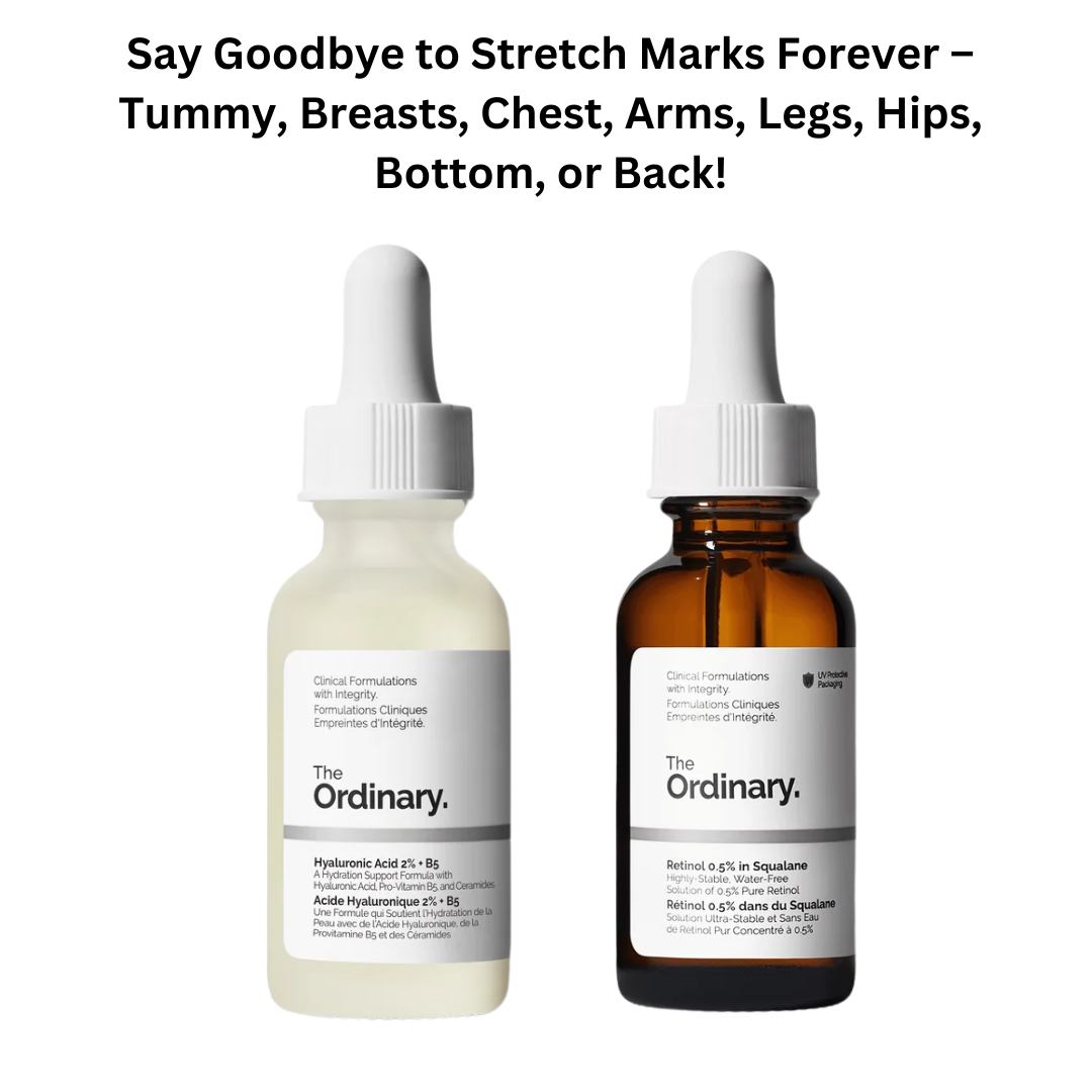 Stretch Marks Gone Forever – Tummy, Breasts, Chest, Arms, Legs, Hips, Bottom, or Back!