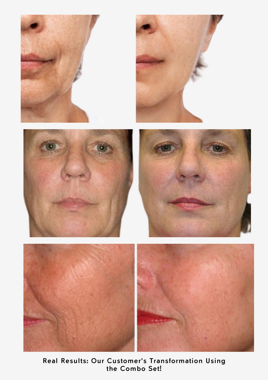 The Ordinary Anti-Aging Set - Sunscreen for dark spots - view 2