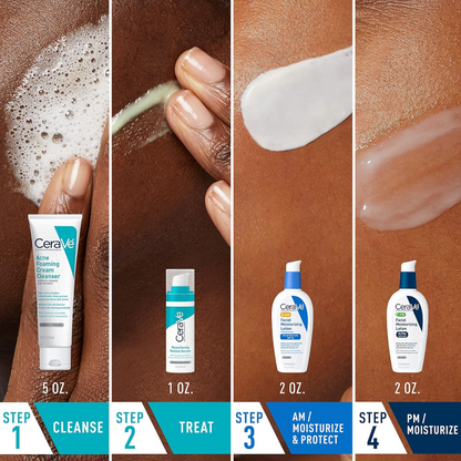 CeraVe Skin Care Set for Acne and Breakouts Treatment - Treatment for acne - view 2