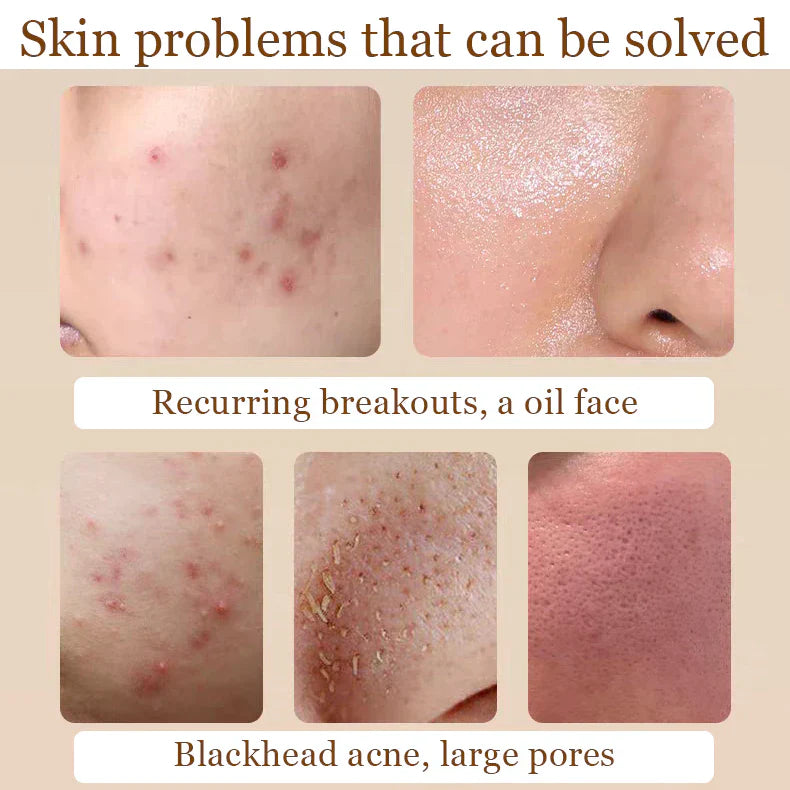 The Ordinary Niacinamide + Glycolic Acid Duo - Sunscreen for acne - view 3