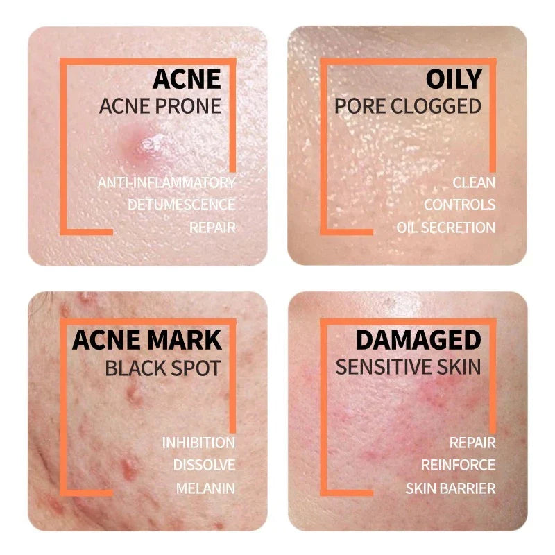 The Ordinary Niacinamide + Glycolic Acid Duo - Sunscreen for acne - view 6