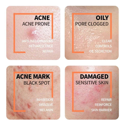 The Ordinary Niacinamide + Glycolic Acid Duo - Sunscreen for acne - view 6