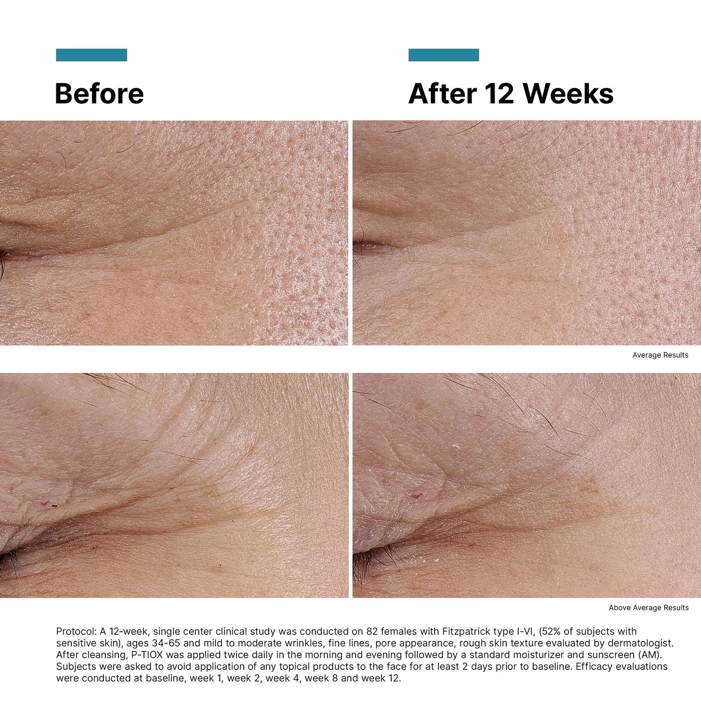 SkinCeuticals P-TIOX (3-Pack Value Set) - Sunscreen for anti-aging - view 5