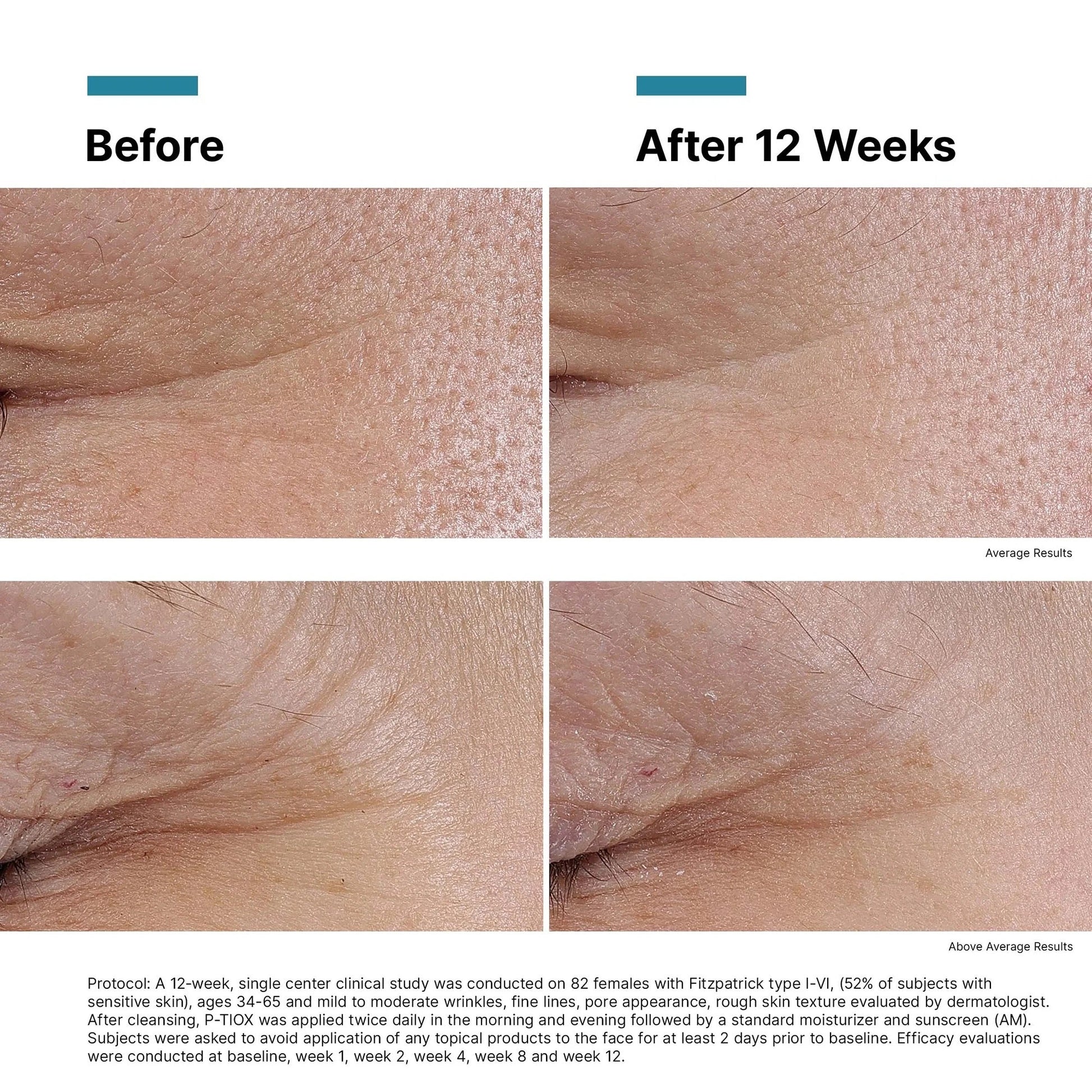 SkinCeuticals P-TIOX (3-Pack Value Set) - Sunscreen for anti-aging - view 5