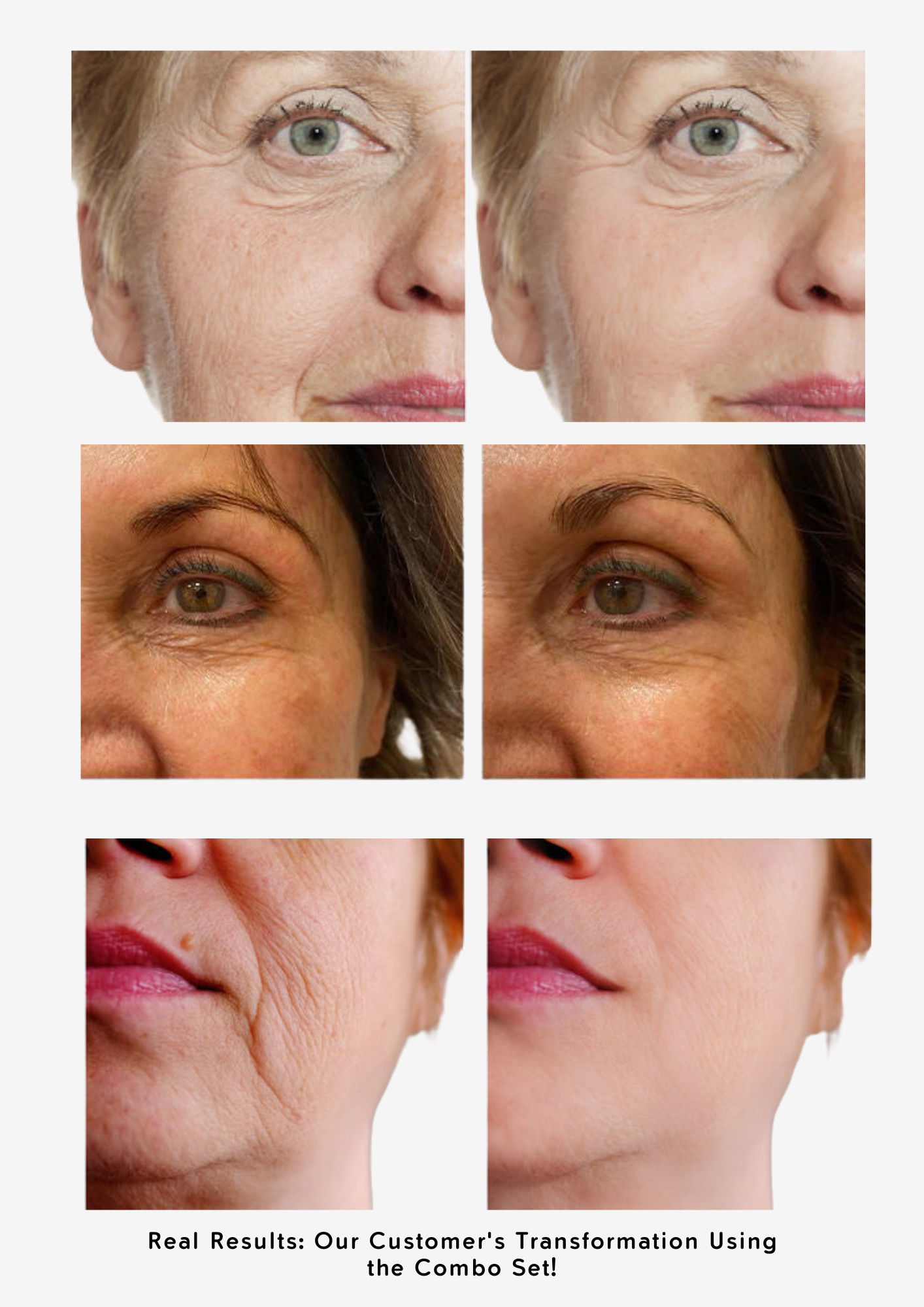 The Ordinary Youthful Skin Set - Sunscreen for dark spots - view 2